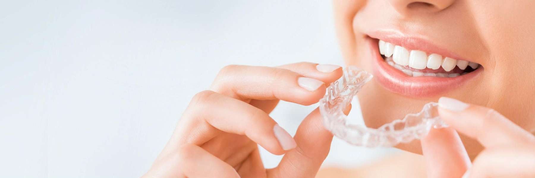 Invisalign® Clear Aligners | Dentist